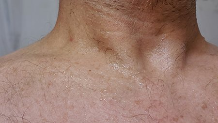 Geceleri Her Zaman Terliyorsanız, Bunun Nedeni Bu Hormonal Bozukluk Olabilir