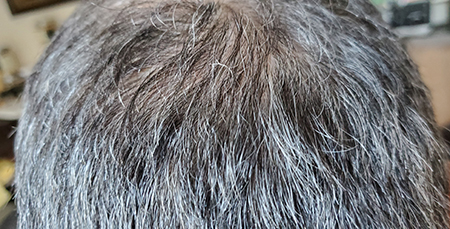Dermatologlar Bu Yiyeceklerin Daha Kalın ve Güçlü Saçlara Sahip Olmanızda Size Yardımcı Olacağını Açıkladı