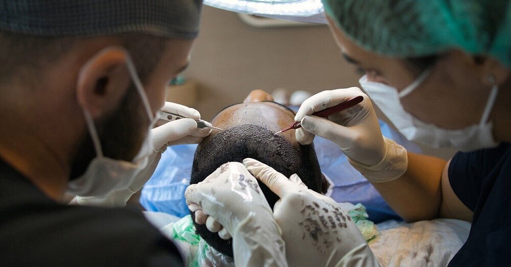 hair-transplant-7518352.jpg