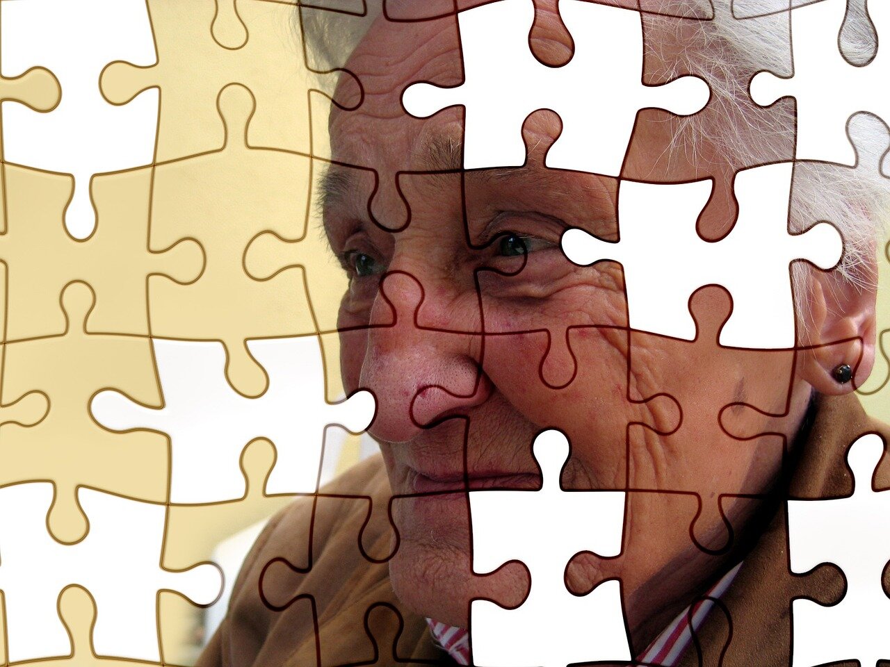 Beyin Otopsileri Alzheimer Hastalığının Arkasında Yeni Bir Suçluyu Gösteriyor
